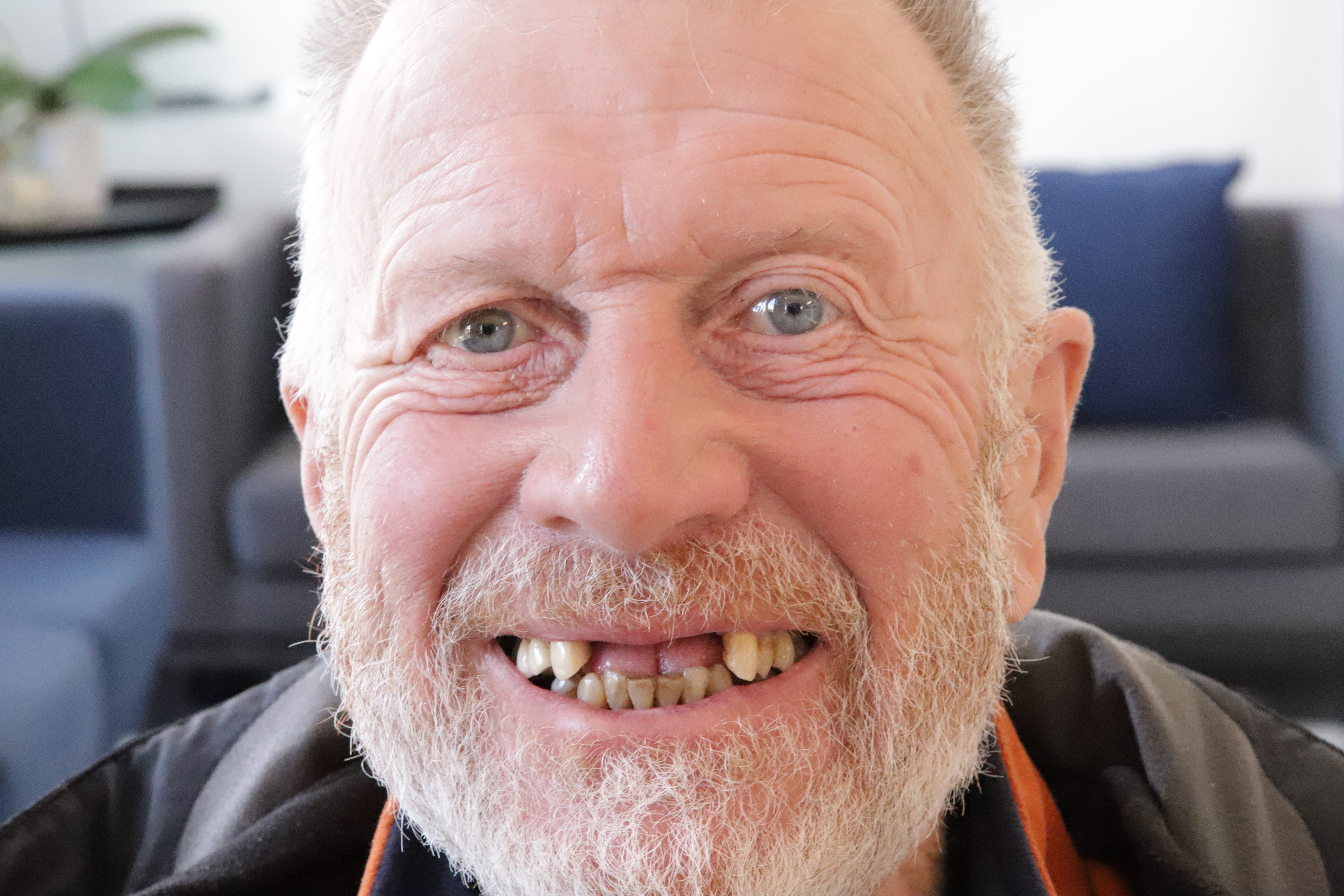 Before implant treatment